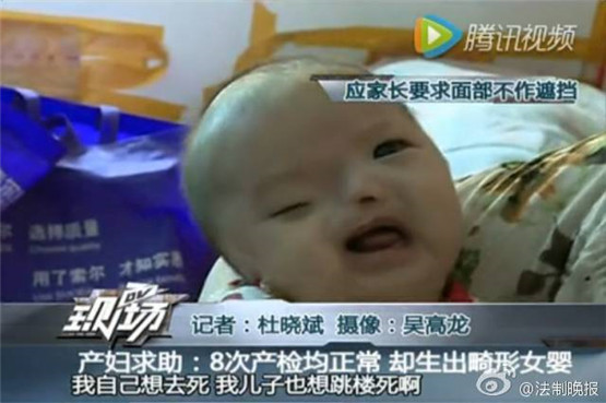 我