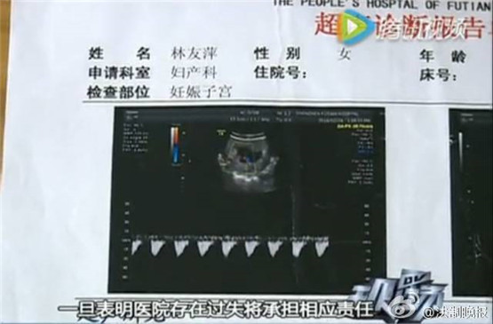 試試