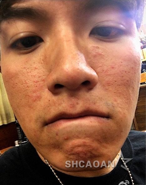 爛臉柯震東入圍第53屆金馬獎顏值回歸竇靖童入圍金馬有點懵(圖)