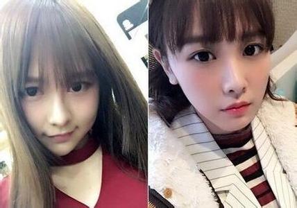 SNH48唐安琪已能下床 SNH48唐安琪烧伤经过及原因揭晓