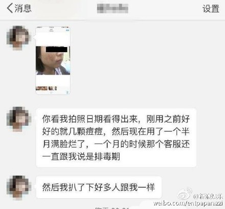 张庭及众多明星合作的TST品牌    再次遭消费者投诉使用后竟毁容