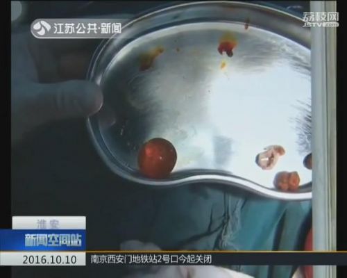 男童误食水宝宝险送命 水宝宝到底是什么东西？