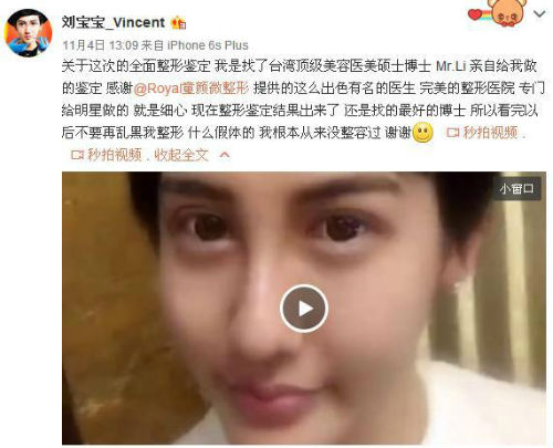 劉梓晨整容鑒定結果視頻:未整容? 劉梓晨是真的很有錢么