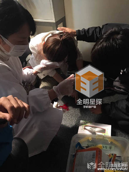 戚薇受傷情況有點嚴重面部需要縫合  戚薇受傷已緊急送往醫院