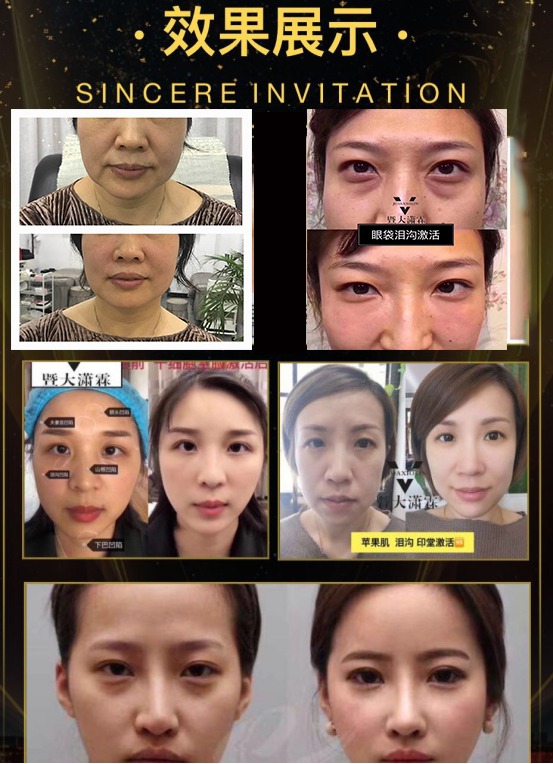 4ae61885375a3aad5952bae5ffafcb3 拷贝