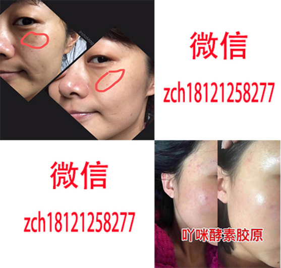 yamii酵素工厂在哪里、总部是哪里的、拿货价格