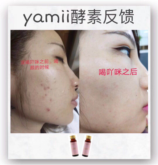 yamii胶原蛋白效果怎么样、用户使用反馈怎么样