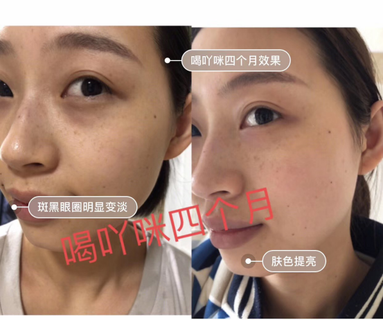 yamii胶原蛋白效果怎么样、用户使用反馈怎么样