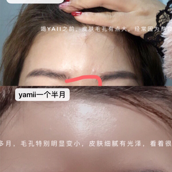 yamii酵素如何代理加盟、代理加盟需要多少钱