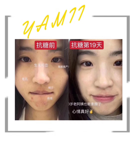 yamii酵素如何代理加盟、代理加盟需要多少钱