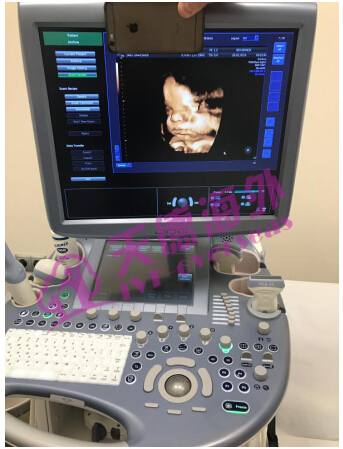 俄罗斯试管婴儿水平分析-我的莫斯科求子之旅