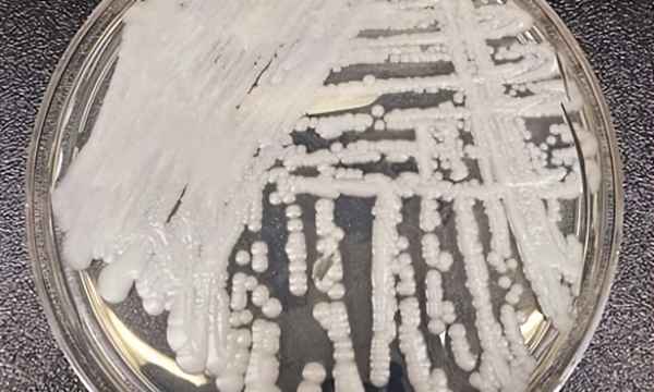 真菌感染一輩子好不了-男性真菌感染能自愈嗎