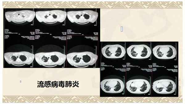 鱼的呼吸实验视频教程、鱼的呼吸实验视频教程大全
