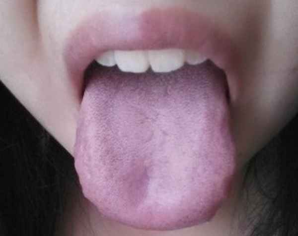 薏米和赤小豆熬粥的功效—蓮子薏米赤小豆粥的功效