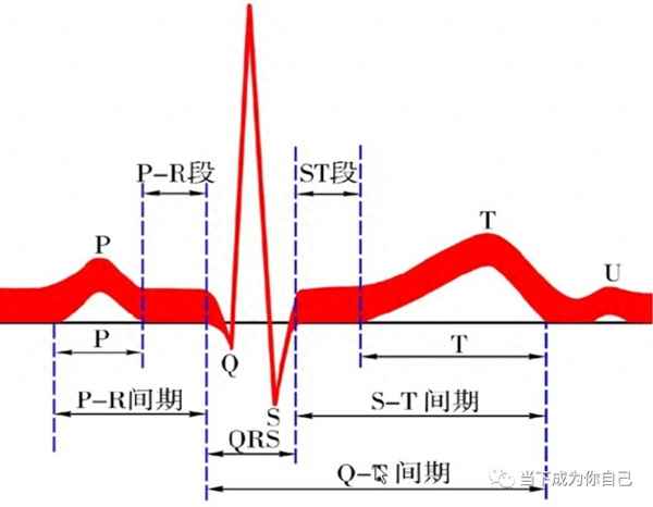 心梗心电图怎么看图解_24个心电图巧记口诀