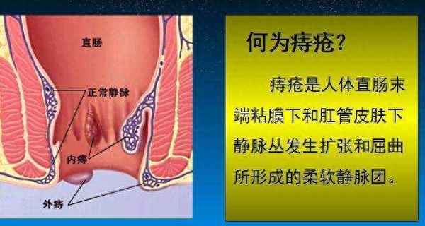 皮膚長釘子瘡圖片-皮膚上長釘子是什么意思