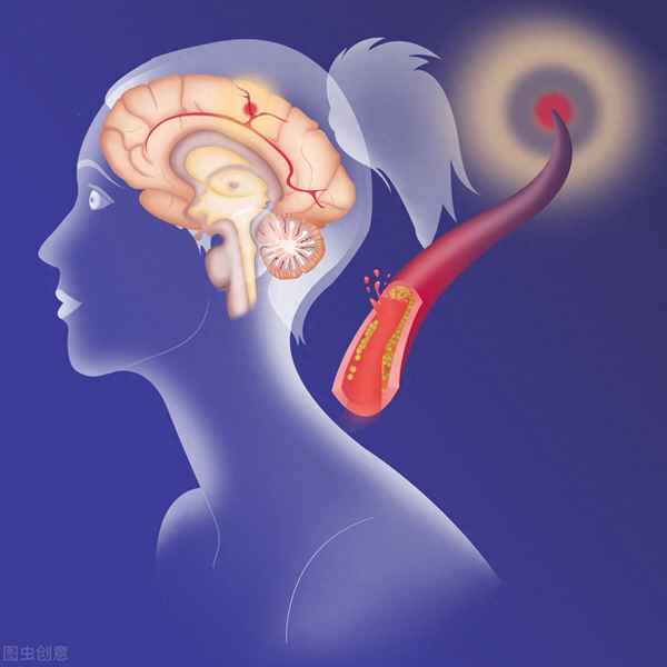 腦絡通膠囊怎么吃,腦絡通膠囊吃多久為一療程