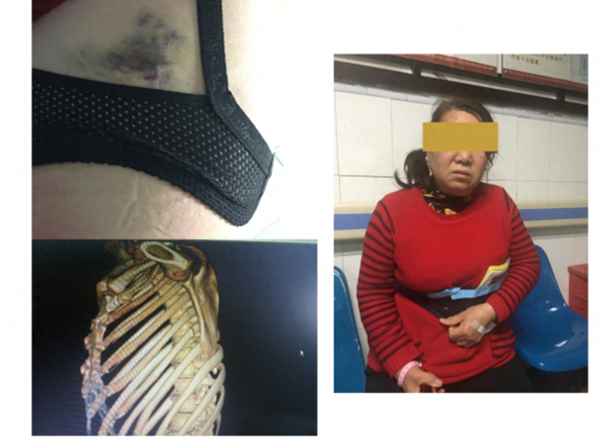 63岁保洁员被打最新消息-63岁保洁员被业主飞踹结局