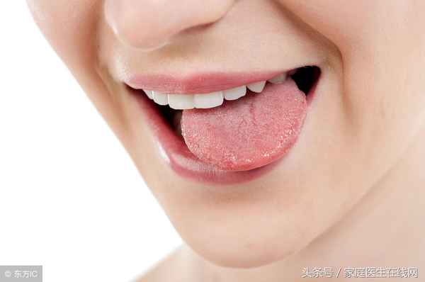 如何看舌苔健康狀況,小兒積食舌苔圖片