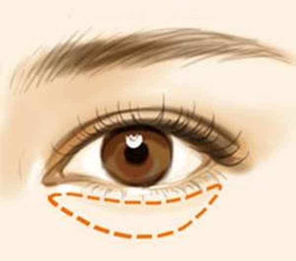 西安再生科技眼袋公司怎么样,西安再生科技眼袋公司怎么样知乎