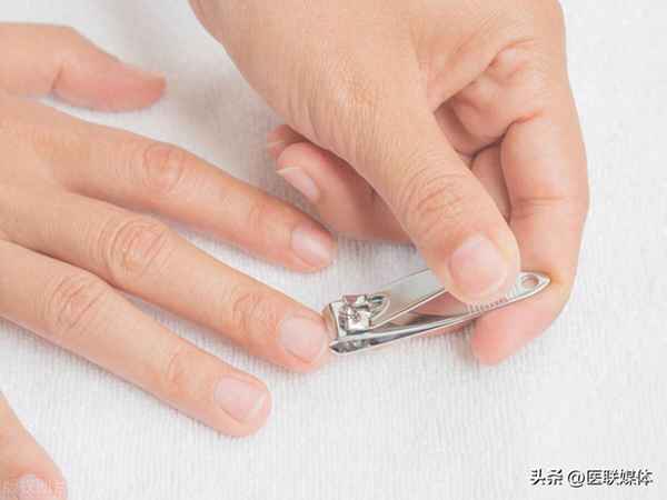 指甲盖短怎么才能变长—手指甲盖短怎么变细长