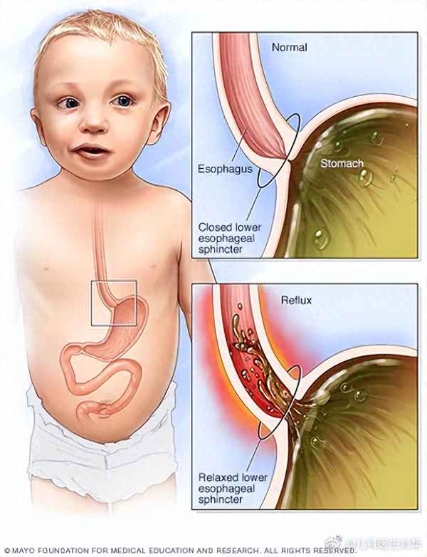 正常吐奶和异常吐奶;宝宝频繁吐奶怎么办？正常吗