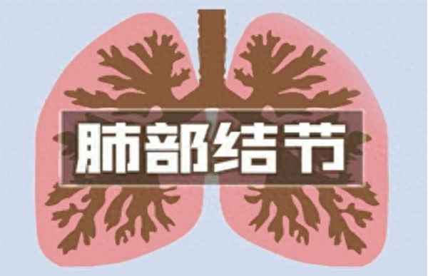 真菌肺部感染治疗需要多长时间(真菌肺炎感染的早期症状)