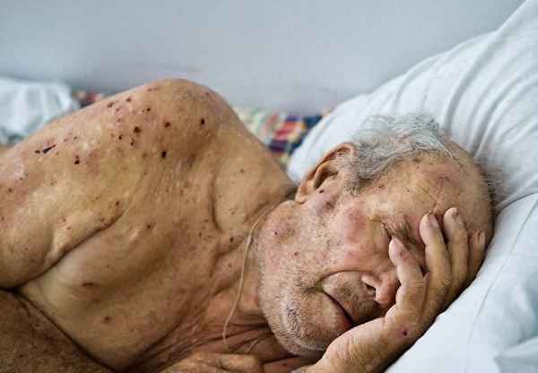 为绝症倾家荡产值得吗-绝症求死