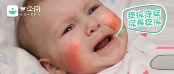 宝宝湿疹有什么好办法-宝宝湿疹有什么好办法？脸上红脖子红疹问题该怎么解决!