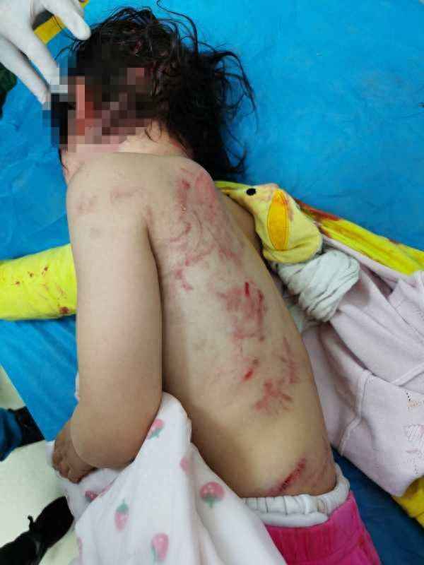 小孩被小区狗咬了物业有责任吗,物业最怕的三个投诉部门