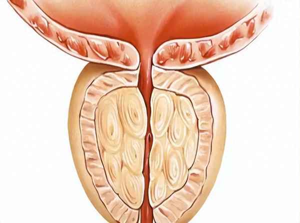 怎么判断男性有没有炎症、怎么判断男性有没有炎症做尿检检查