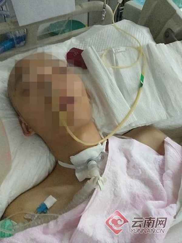 最近昆明坠楼事件_最近昆明坠楼事件28楼图片