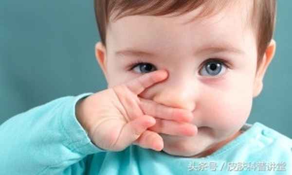 皮膚上長毒瘡是什么原因,皮膚上長毒瘡是什么原因引起的