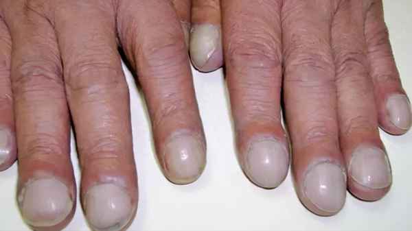 如何让指甲床变大-怎么样让指甲床变长