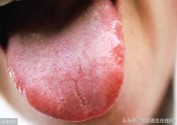 什么樣的舌苔是健康的;男人舌苔厚白是腎虛嗎