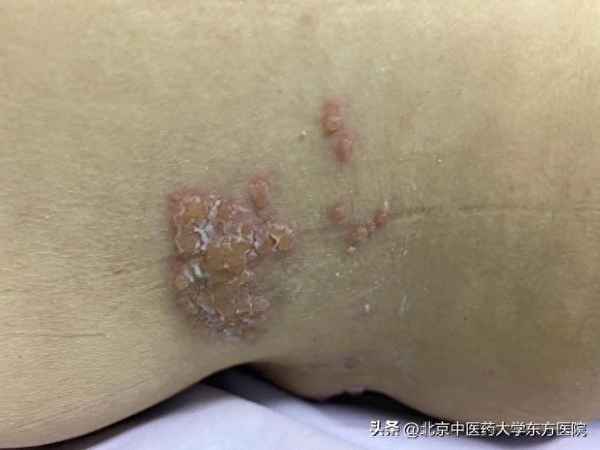 中國(guó)慢性疼痛患者比例,我國(guó)疼痛患者人數(shù)