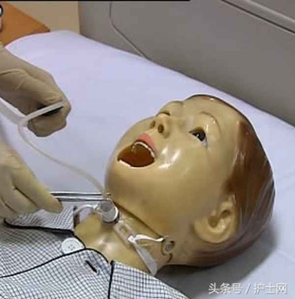吸痰前要调高氧气流量吗(吸痰前吸氧浓度为多少？) - 寻医问药 - 华网，华网资讯，华网头条，华人网络家园