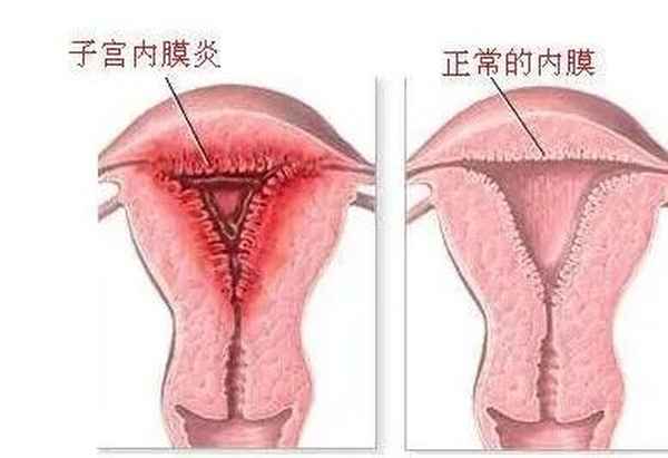 多西环素治解脲支原体好了—多西环素治疗解脲支原体疗程是几天