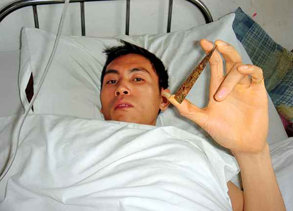 男子给女子按摩头部、给女人按摩头部