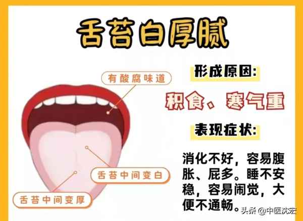 健康舌苔的标准图片—健康舌苔的标准图片里面 - 寻医问药 - 华网,华网资讯,华网头条,华人网络家园