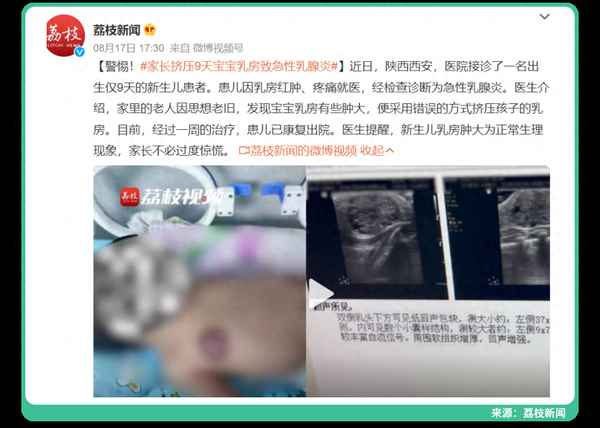 乳腺炎刚开始图片、乳腺炎前兆图片大全