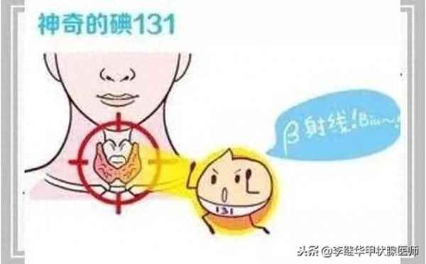碘131试验是啥意思-碘131试验会心率快吗 - 健康资讯 - 华网,华网资讯,华网头条,华人网络家园