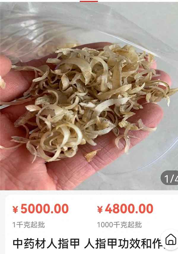 人的指甲可以吃吗、咬指甲很严重是心理疾病吗