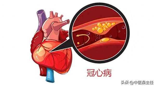 保元湯配方豬蹄牛肉鯽魚;保元湯做法