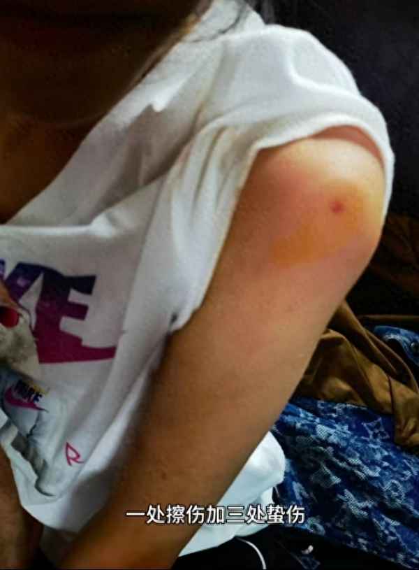 在景区被蜜蜂蛰了怎么赔偿-游客被蜜蜂蛰了怎么处理