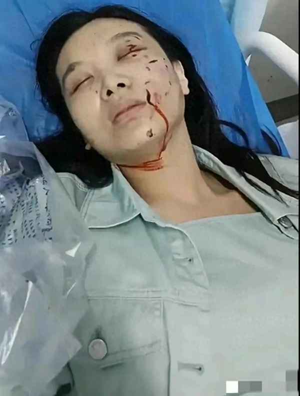 娛樂圈縱狗傷人的明星致人毀容;哪位明星的狗把人咬傷了