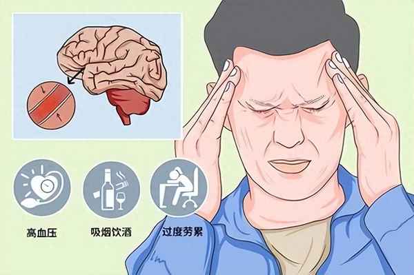 紧张性头疼的治疗方法(紧张性头痛怎么自愈)
