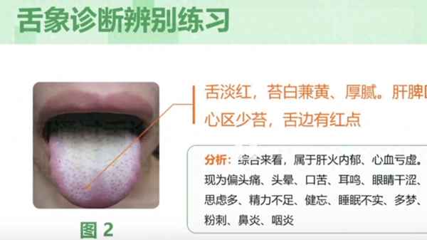 健康2、健康證去哪里辦,怎么辦理,需要什么材料