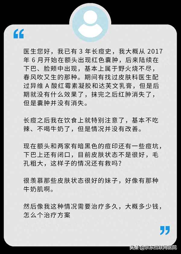 克林霉素磷酸酯外用溶液治疗痘痘、克林霉素磷酸酯外用溶液可以去痘痘吗