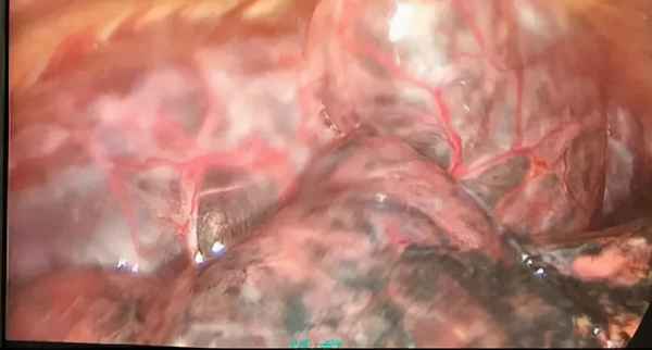吸煙有害健康圖片大全,吸煙有害身體健康的圖片